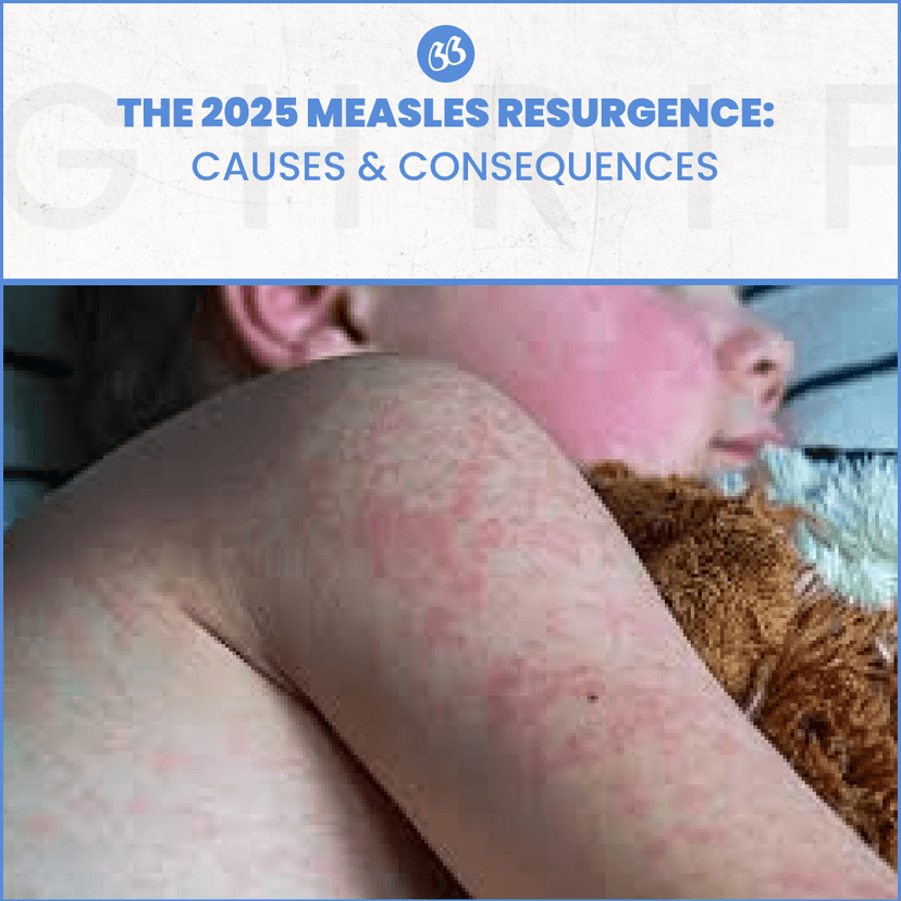 The 2025 Measles Resurgence: Causes & Consequences
